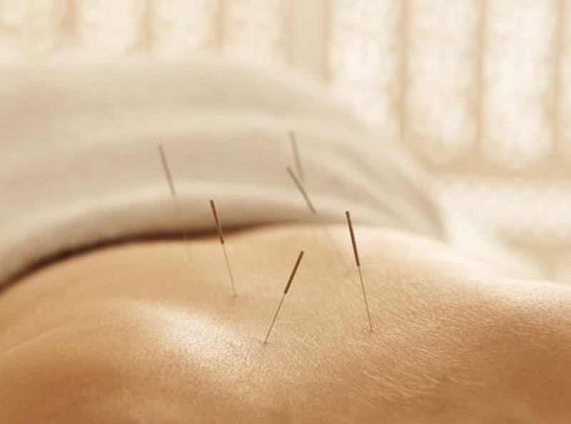 中医理疗：传统与现代的完美结合